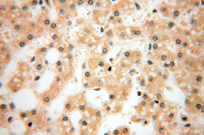 LKB1 Antibody in Immunohistochemistry (Paraffin) (IHC (P))