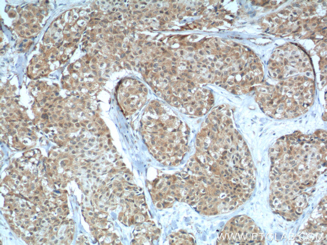 LKB1 Antibody in Immunohistochemistry (Paraffin) (IHC (P))