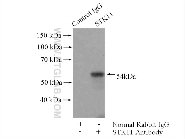 LKB1 Antibody in Immunoprecipitation (IP)