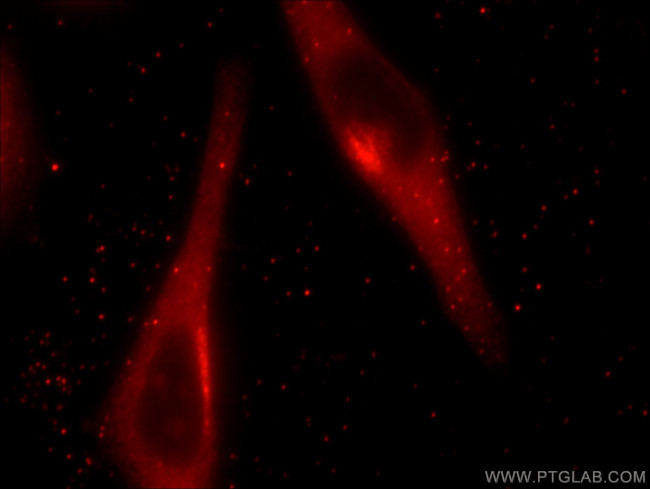 GRASP65/GORASP1 Antibody in Immunocytochemistry (ICC/IF)