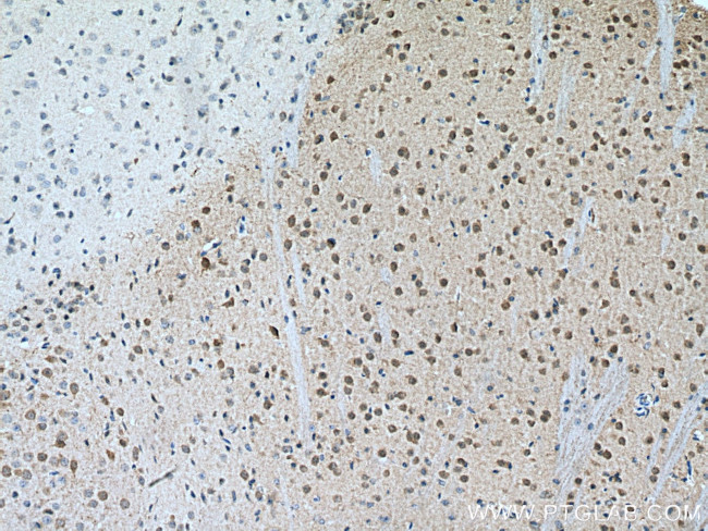 DARPP32 Antibody in Immunohistochemistry (Paraffin) (IHC (P))