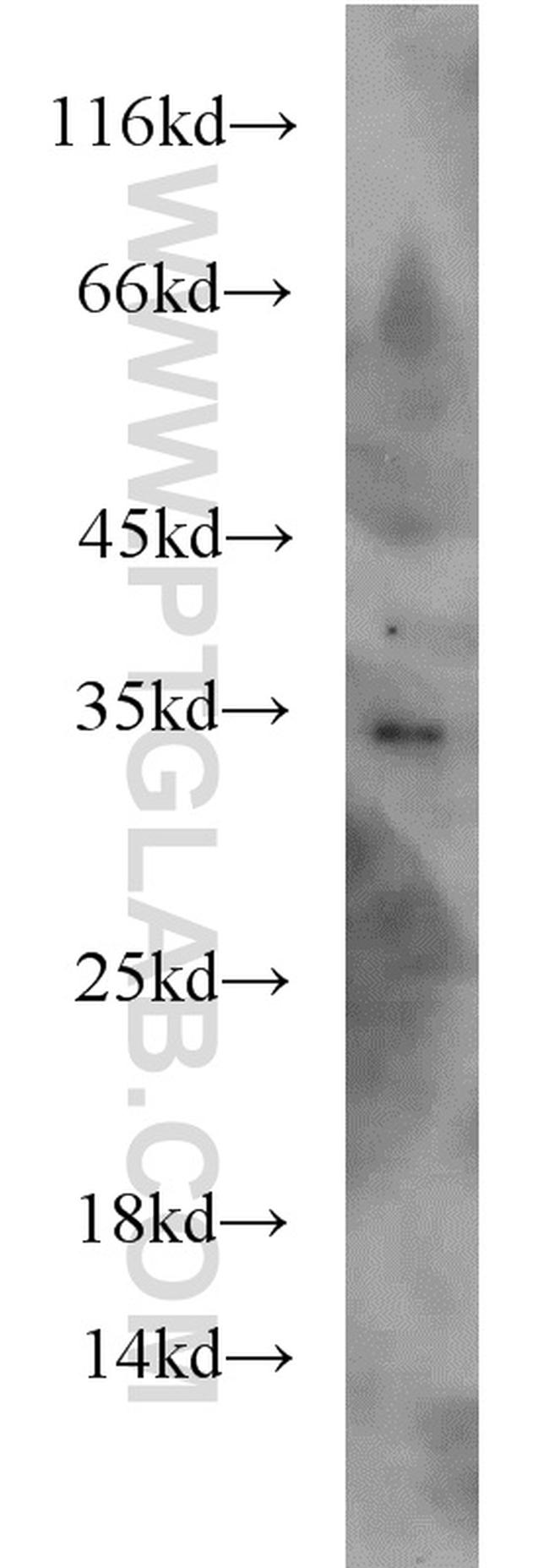 DARPP32 Antibody in Western Blot (WB)