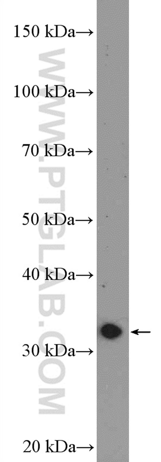 DARPP32 Antibody in Western Blot (WB)