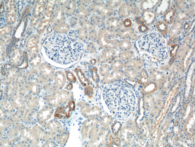 RHOA Antibody in Immunohistochemistry (Paraffin) (IHC (P))