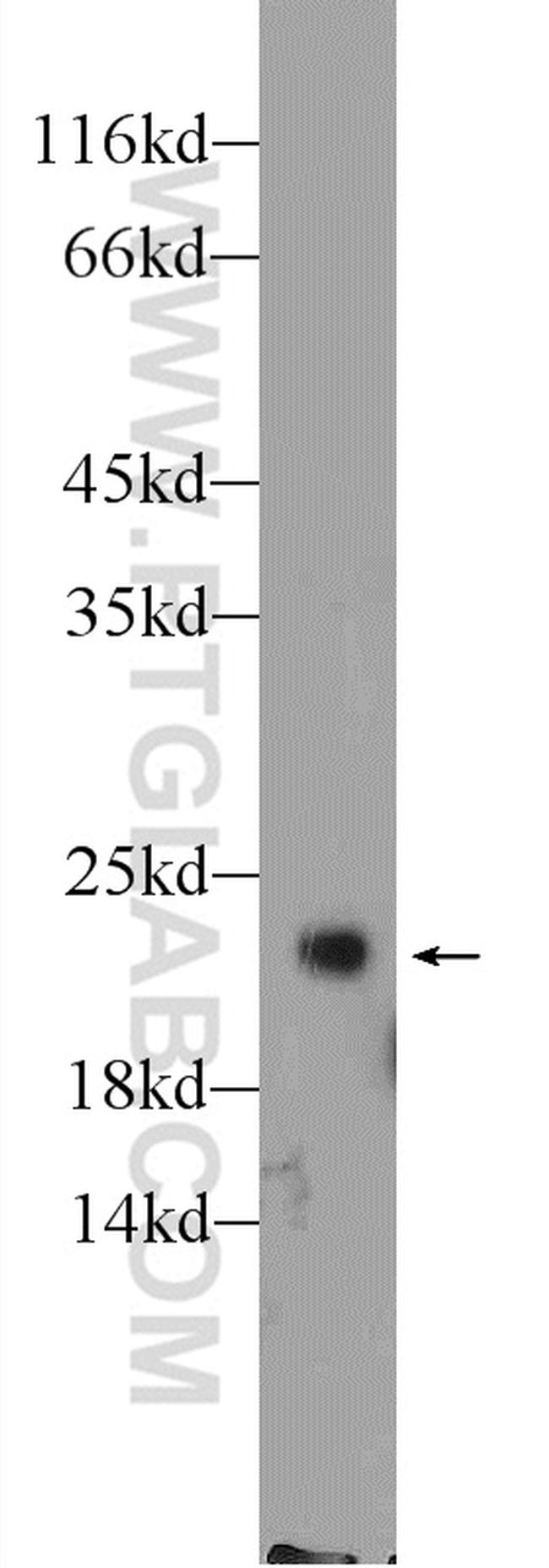 RHOA Antibody in Western Blot (WB)