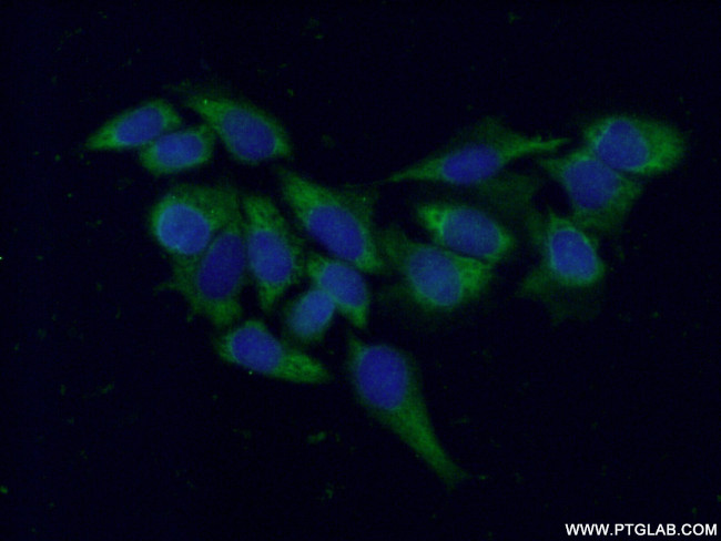 RHOA Antibody in Immunocytochemistry (ICC/IF)