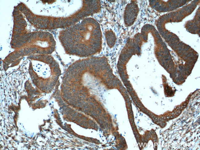 RHOA Antibody in Immunohistochemistry (Paraffin) (IHC (P))