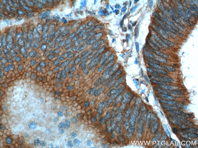 RHOA Antibody in Immunohistochemistry (Paraffin) (IHC (P))