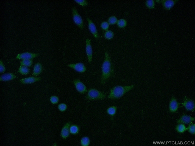 CNOT8 Antibody in Immunocytochemistry (ICC/IF)