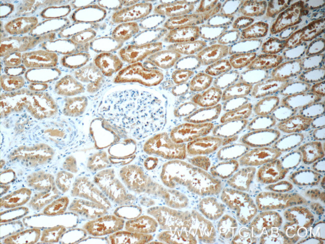 CNOT8 Antibody in Immunohistochemistry (Paraffin) (IHC (P))