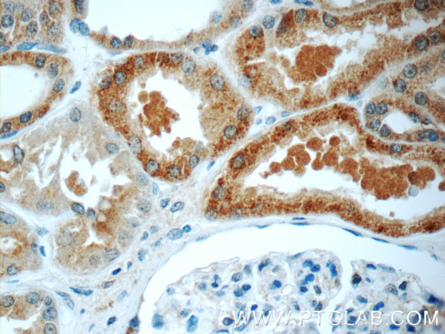 CNOT8 Antibody in Immunohistochemistry (Paraffin) (IHC (P))