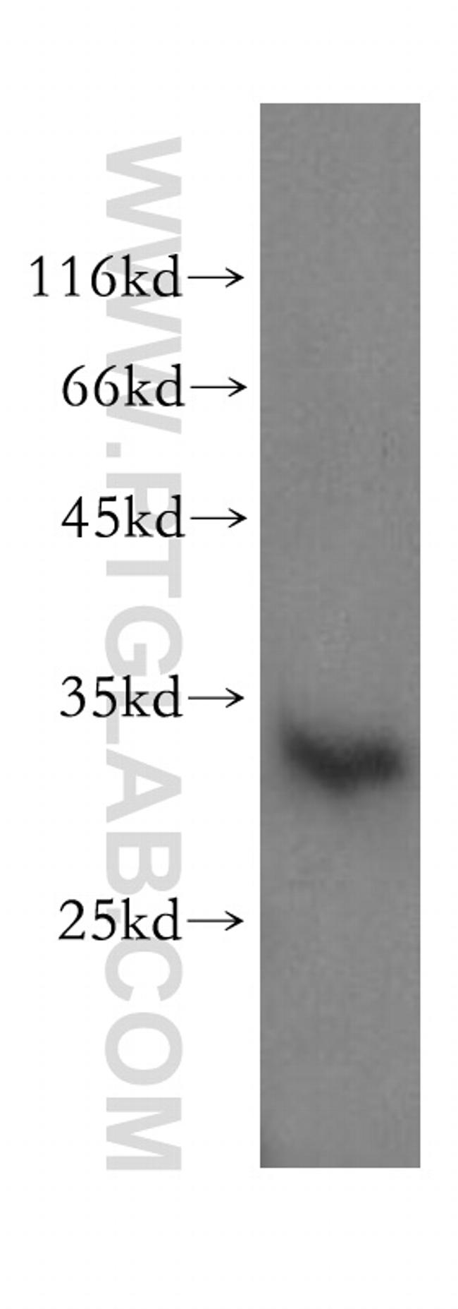 CNOT8 Antibody in Western Blot (WB)