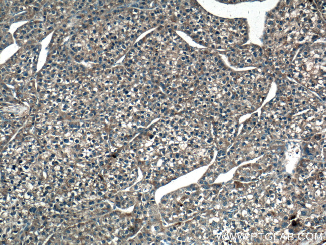 GUK1 Antibody in Immunohistochemistry (Paraffin) (IHC (P))