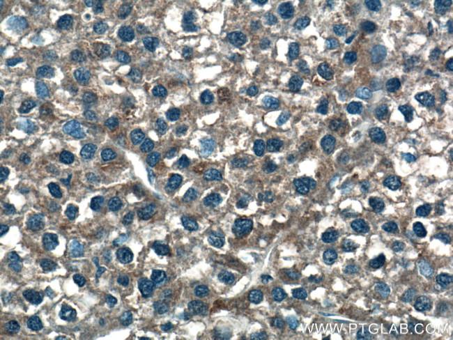 GUK1 Antibody in Immunohistochemistry (Paraffin) (IHC (P))