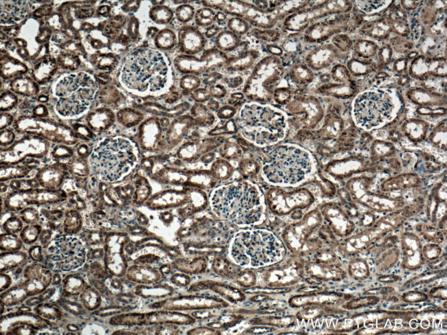 GUK1 Antibody in Immunohistochemistry (Paraffin) (IHC (P))