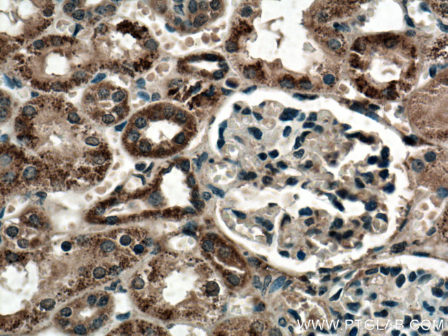 GUK1 Antibody in Immunohistochemistry (Paraffin) (IHC (P))