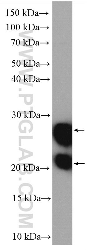 GUK1 Antibody in Western Blot (WB)