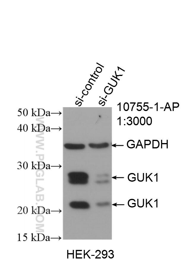 GUK1 Antibody in Western Blot (WB)