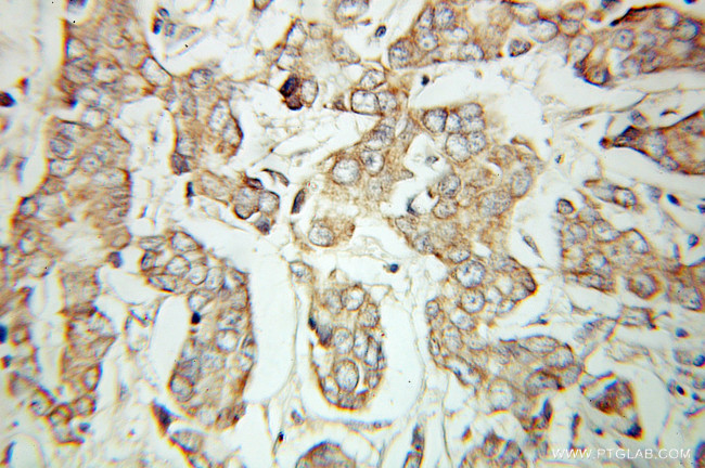 UQCRB Antibody in Immunohistochemistry (Paraffin) (IHC (P))