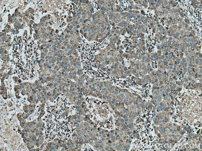 UQCRB Antibody in Immunohistochemistry (Paraffin) (IHC (P))