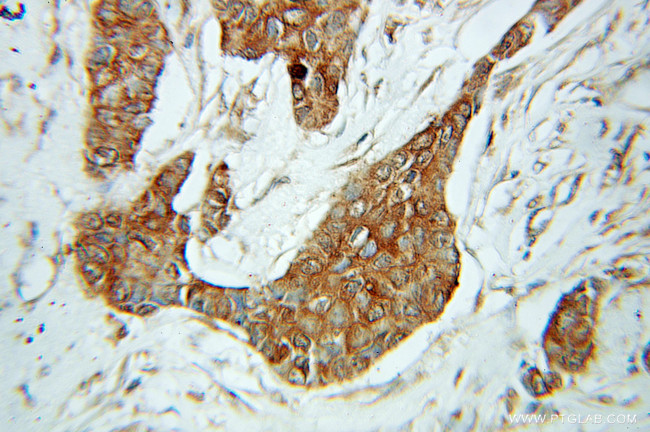 AHCY Antibody in Immunohistochemistry (Paraffin) (IHC (P))