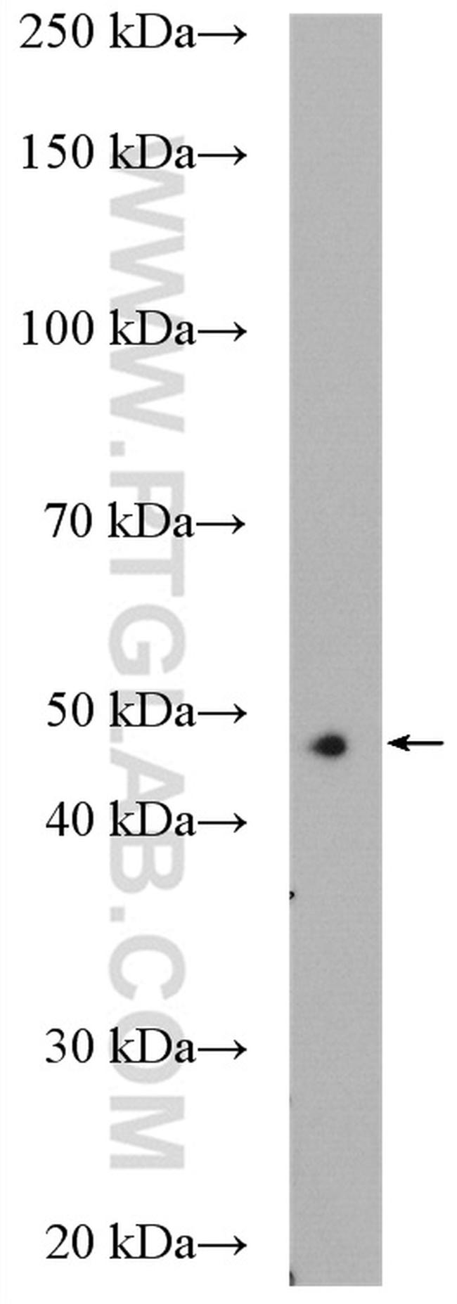 AHCY Antibody in Western Blot (WB)