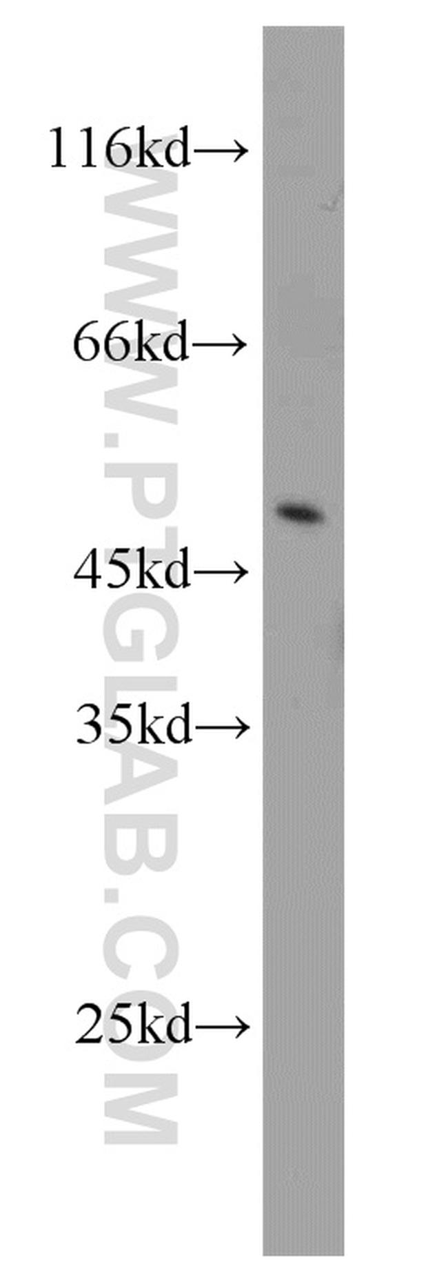 AHCY Antibody in Western Blot (WB)