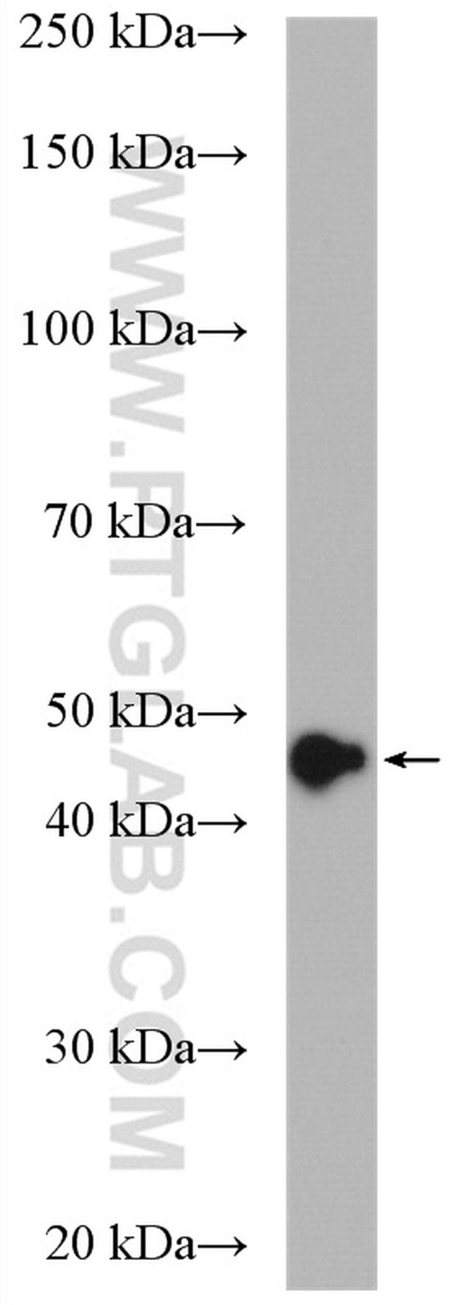 AHCY Antibody in Western Blot (WB)