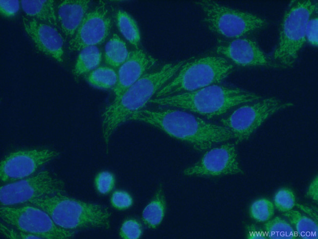 HADHA Antibody in Immunocytochemistry (ICC/IF)