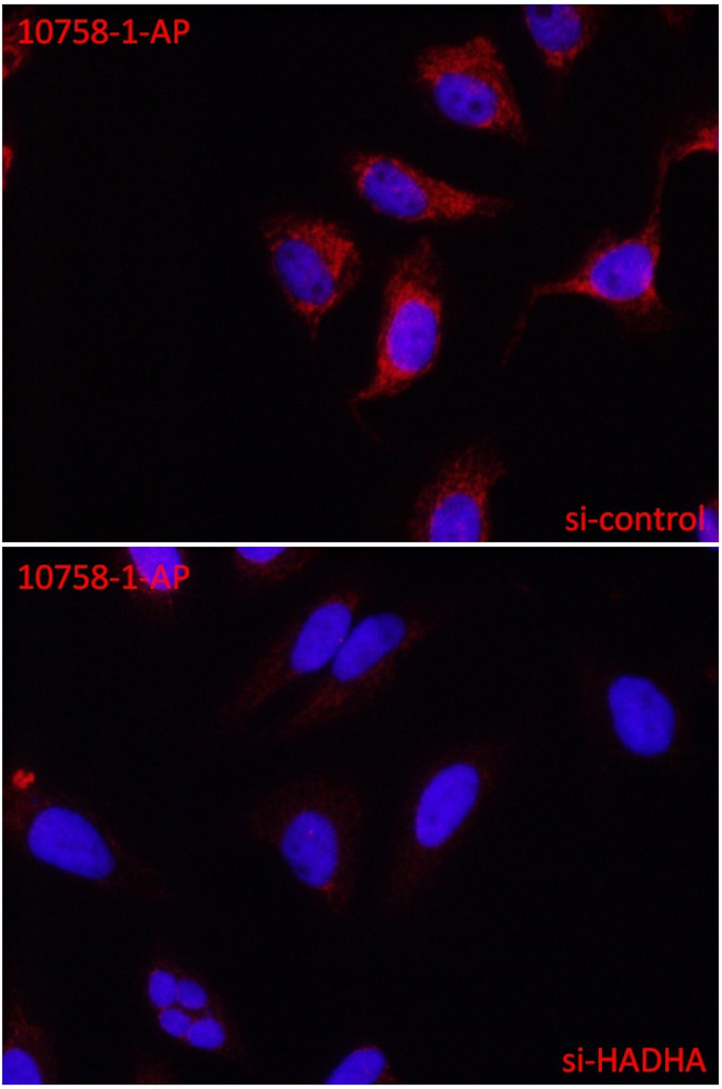 HADHA Antibody in Immunocytochemistry (ICC/IF)