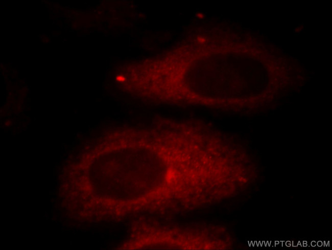 HADHA Antibody in Immunocytochemistry (ICC/IF)