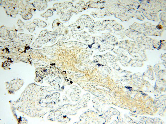 HADHA Antibody in Immunohistochemistry (Paraffin) (IHC (P))