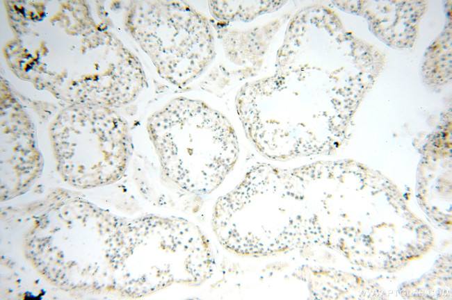 HADHA Antibody in Immunohistochemistry (Paraffin) (IHC (P))