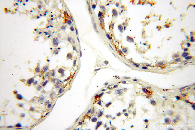 HADHA Antibody in Immunohistochemistry (Paraffin) (IHC (P))