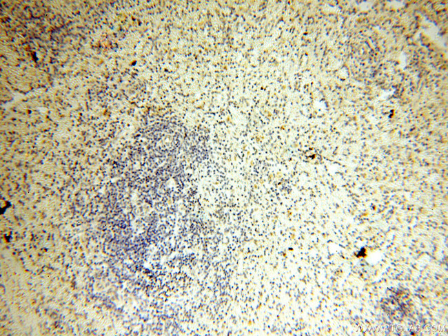 HADHA Antibody in Immunohistochemistry (Paraffin) (IHC (P))