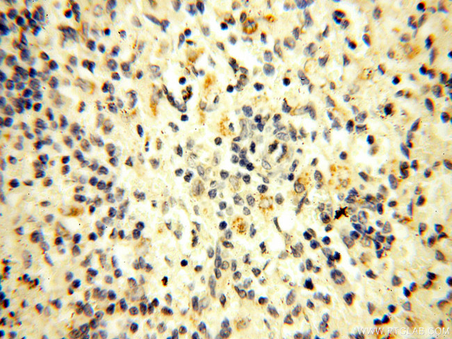 HADHA Antibody in Immunohistochemistry (Paraffin) (IHC (P))