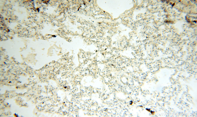 HADHA Antibody in Immunohistochemistry (Paraffin) (IHC (P))