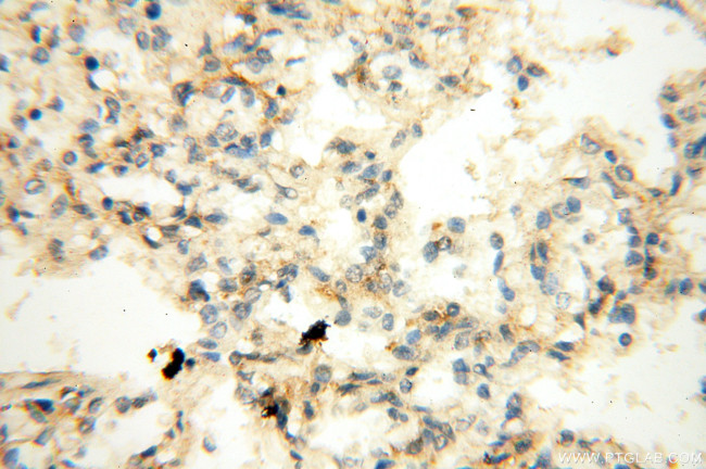 HADHA Antibody in Immunohistochemistry (Paraffin) (IHC (P))