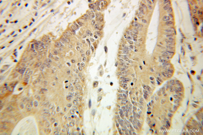 HADHA Antibody in Immunohistochemistry (Paraffin) (IHC (P))