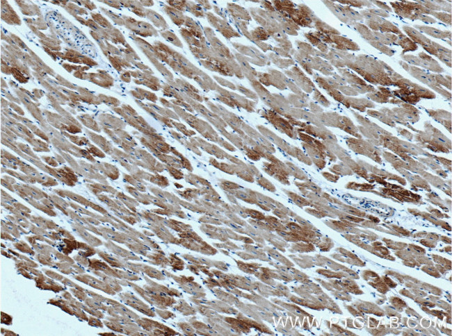 HADHA Antibody in Immunohistochemistry (Paraffin) (IHC (P))