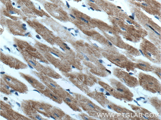 HADHA Antibody in Immunohistochemistry (Paraffin) (IHC (P))