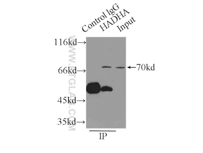 HADHA Antibody in Immunoprecipitation (IP)