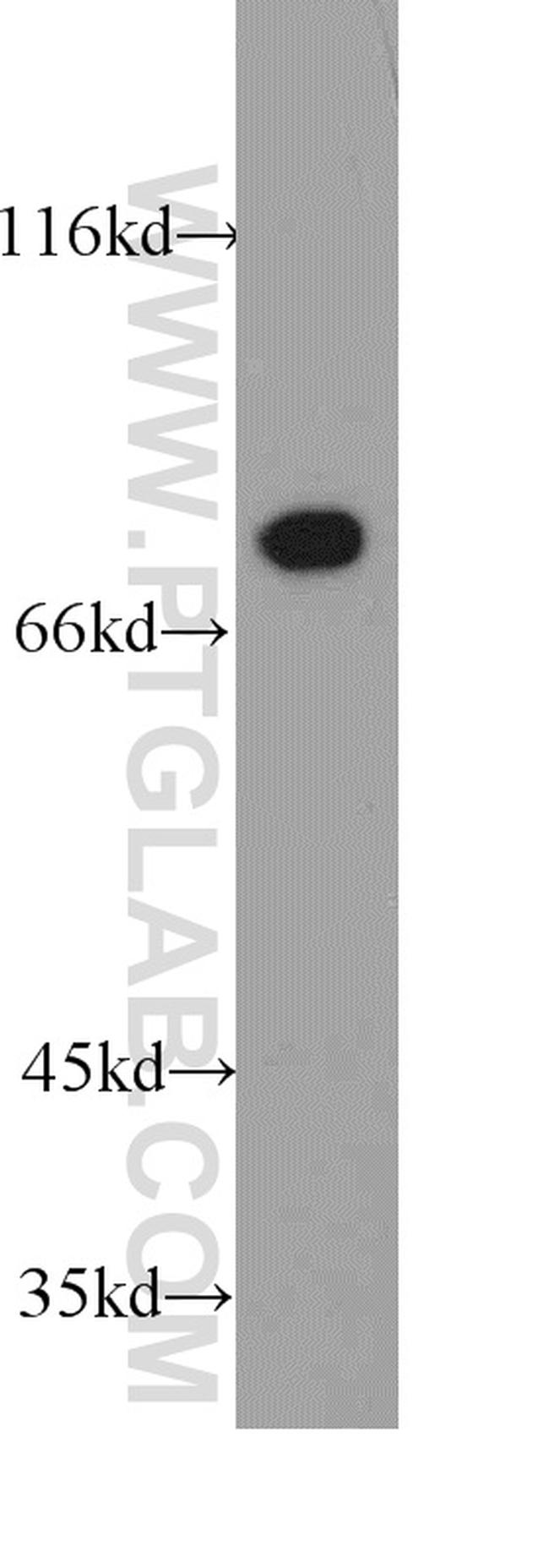 HADHA Antibody in Western Blot (WB)