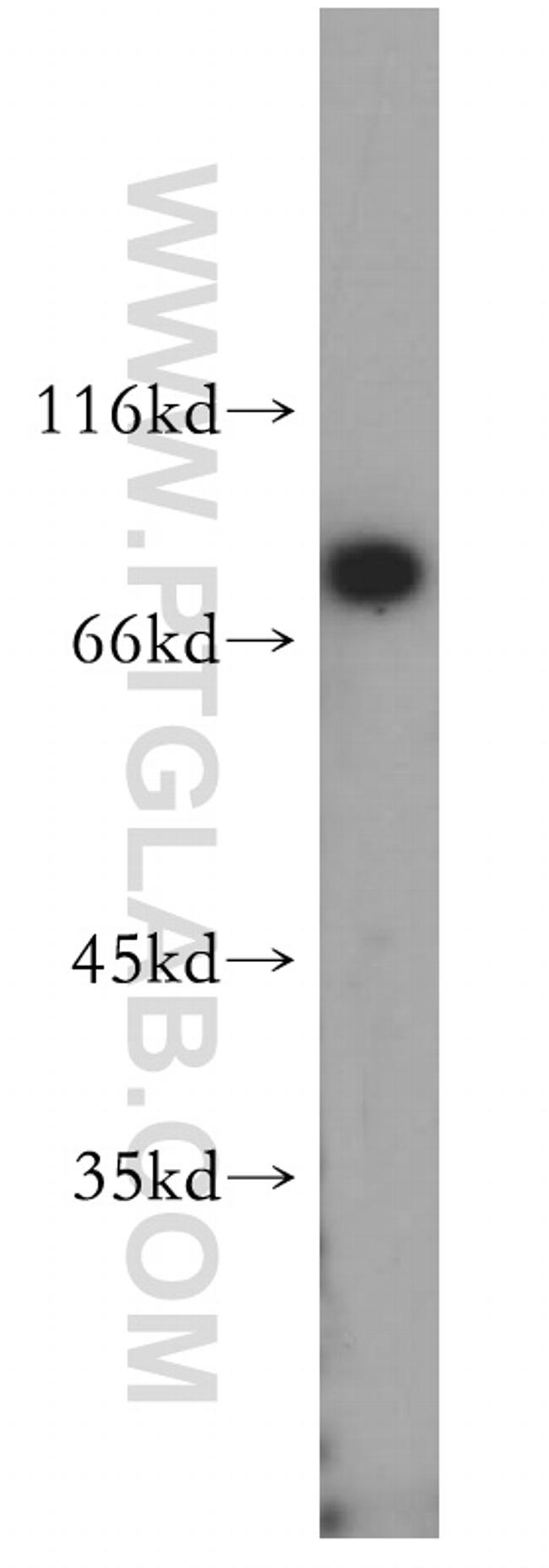 HADHA Antibody in Western Blot (WB)