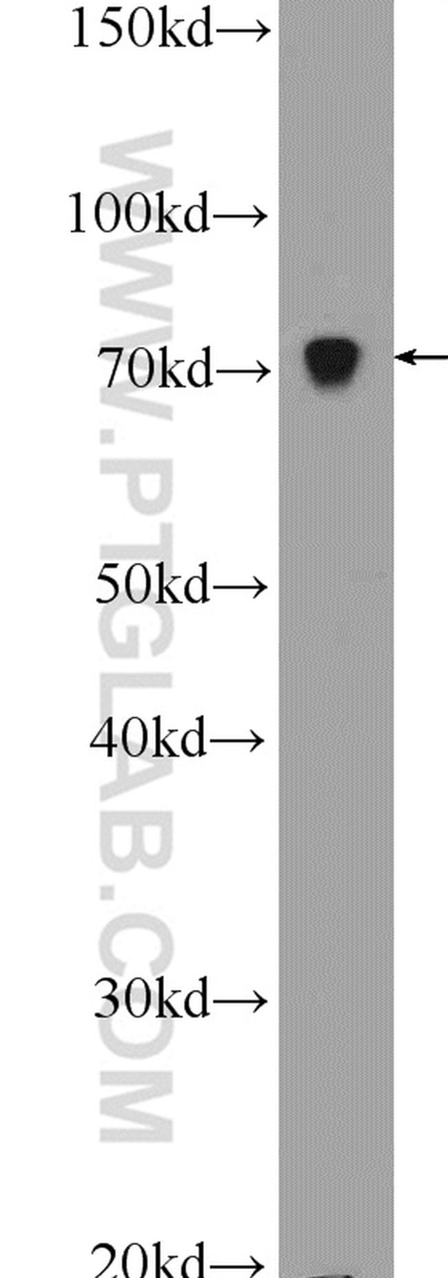 HADHA Antibody in Western Blot (WB)