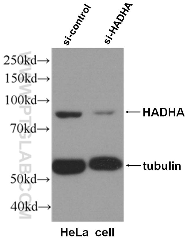 HADHA Antibody in Western Blot (WB)