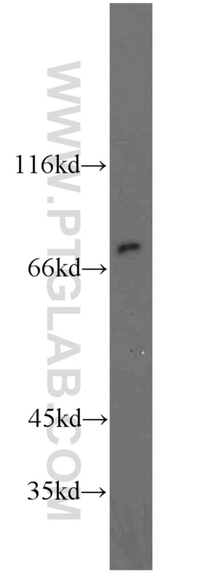 HADHA Antibody in Western Blot (WB)