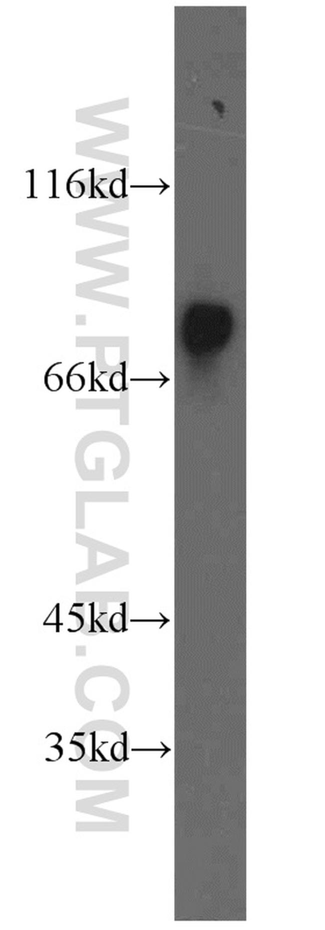 HADHA Antibody in Western Blot (WB)