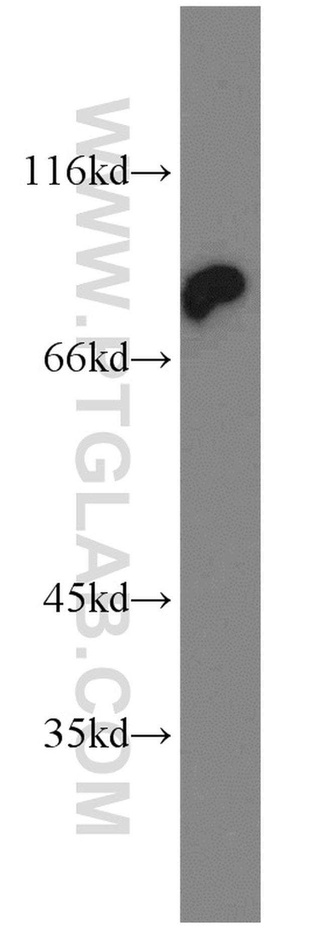 HADHA Antibody in Western Blot (WB)