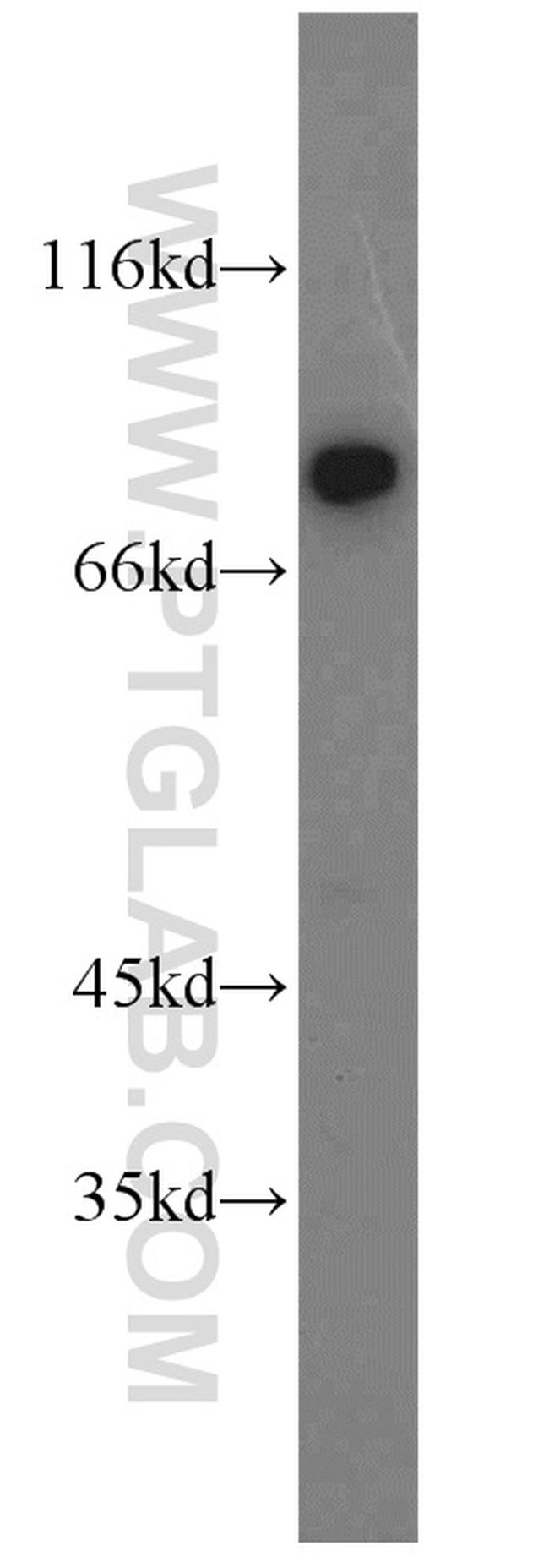 HADHA Antibody in Western Blot (WB)